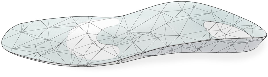 Schematische Darstellung der weichbettenden Cordewener Einlage zur Druckumverteilung